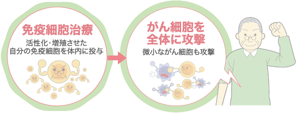 免疫細胞治療→がん細胞を全体に攻撃