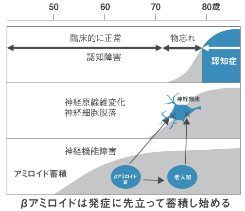 PowerPoint プレゼンテーション