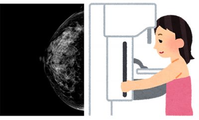 マンモグラフィ検査イメージ