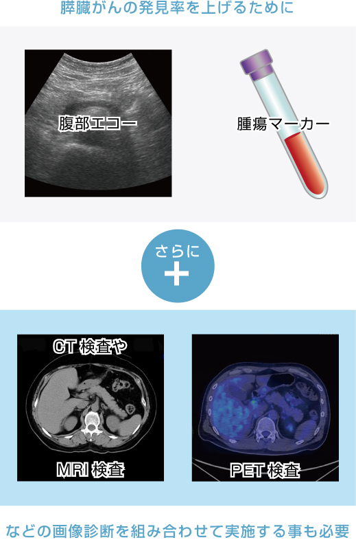 膵臓 癌 初期 症状 ブログ