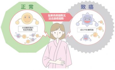 关于以 癌症预防 治疗 检查 为目的面向海外患者的套餐 お知らせ Lsi札幌クリニック